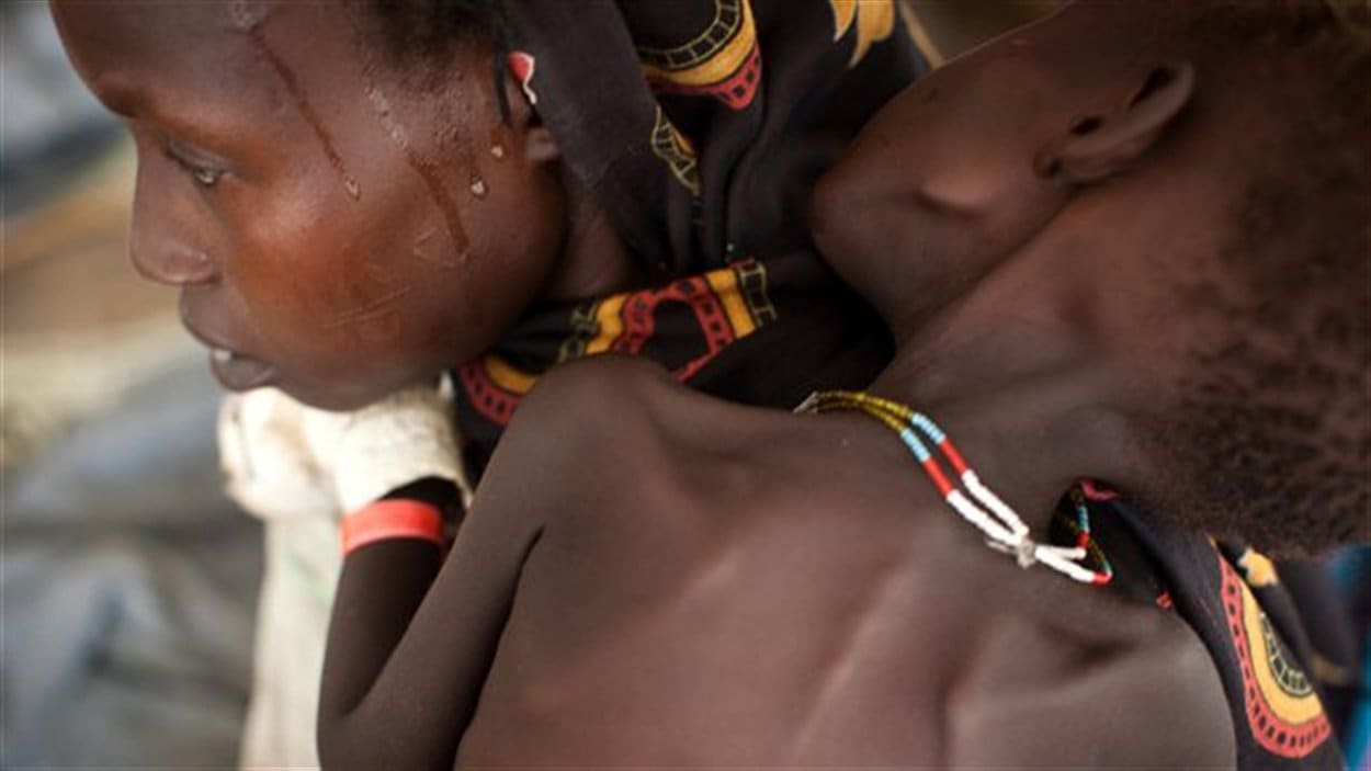 La famine au Soudan du Sud La famine au Soudan du Sud