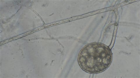 Spores mycorhizes Spores mycorhizes