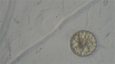 Spores mycorhizes Spores mycorhizes
