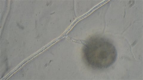 Spores mycorhizes Spores mycorhizes
