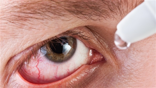 Pour combattre la sécheresse oculaire, il faut cligner des yeux !
