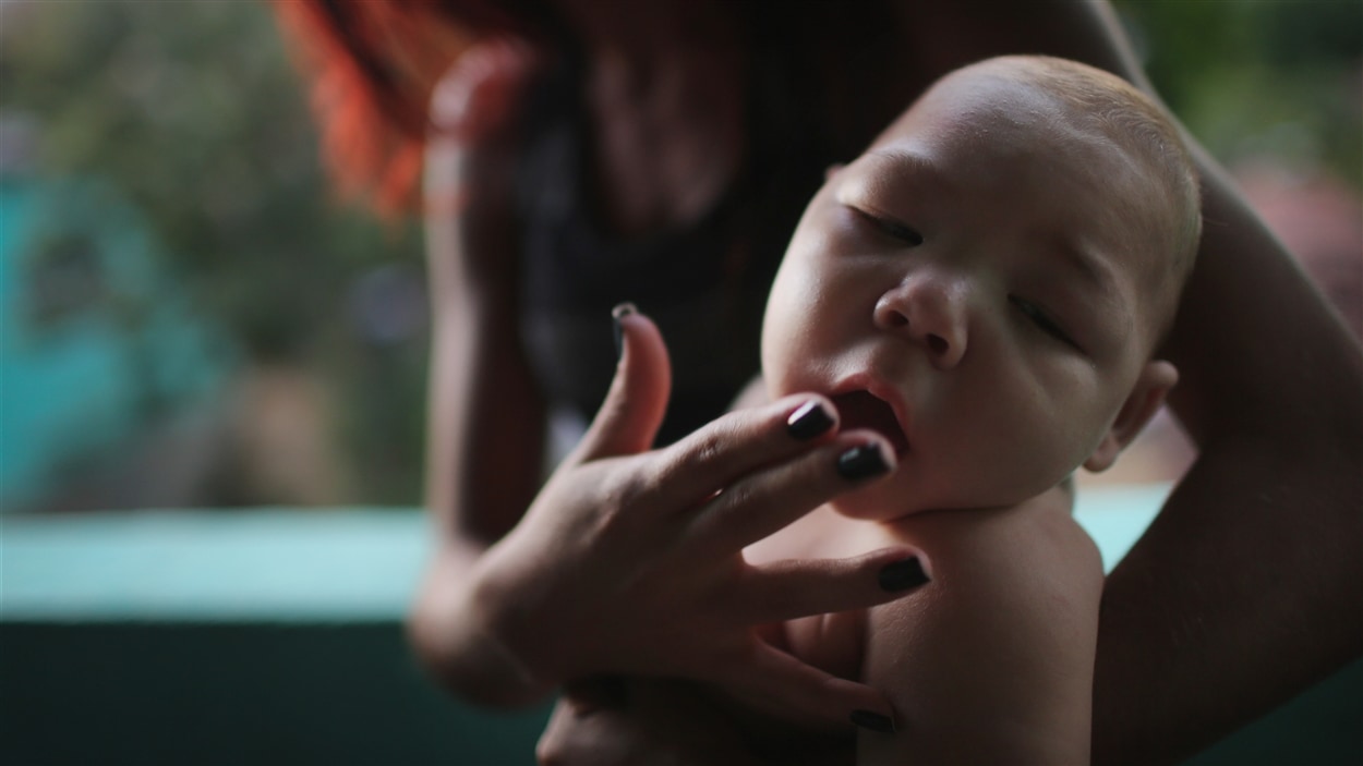 Zika, un virus transmis par un moustique, entraîne des malformations dévastatrices dont la microcéphalie. Zika, un virus transmis par un moustique, entraîne des malformations dévastatrices dont la microcéphalie.